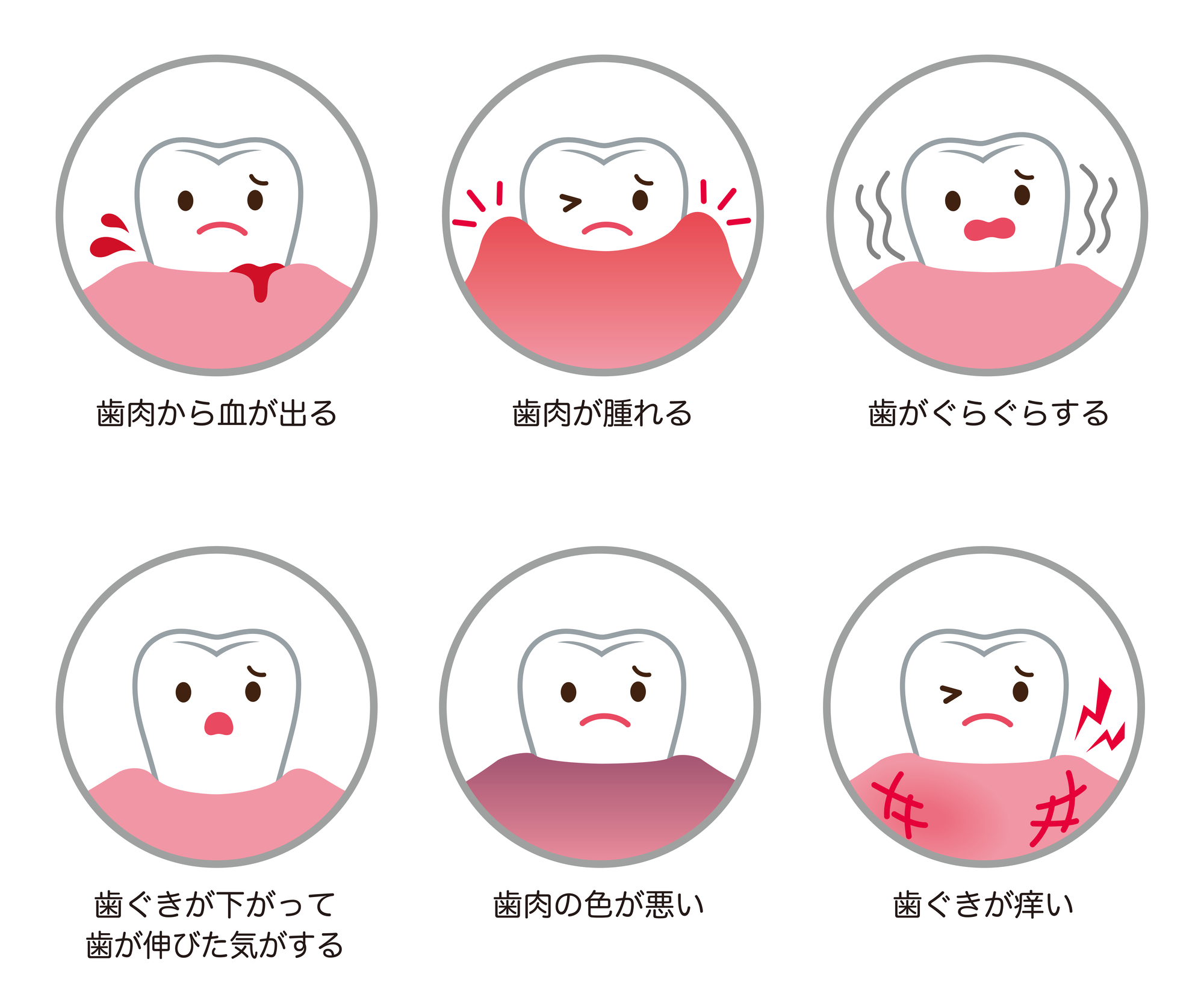 歯周病の主な症状